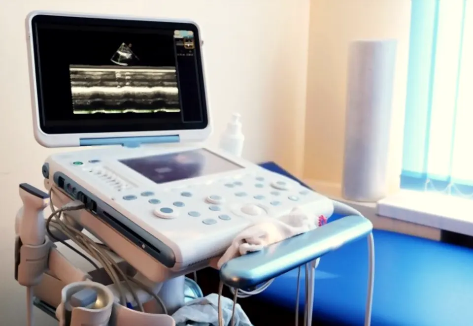 Ultrazvučni aparat u ambulanti ZU Talmma Medic